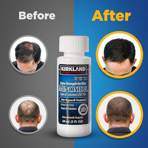 6 Months - Kirkland Generic Minoxidil 5% Mens Hair Loss Regrowth - Total 12 Oz